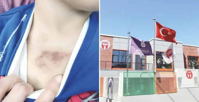 Eyüpsultan’daki kreşte şiddet iddiasıyla ilgili Valilik ve İBB’den peş peşe açıklamalar geldi