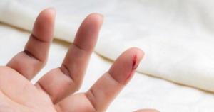 Kagit-Kesigi-Nasil-Gecer-Hizli-Mudahale-ve-Etkili-Tedavi-Yontemleri-300x158 Kağıt Kesiği Nasıl Geçer Hızlı Müdahale ve Etkili Tedavi Yöntemleri