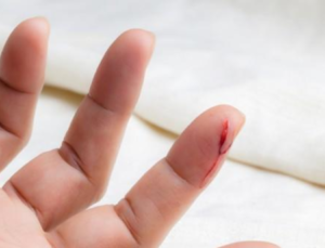 Kağıt Kesiği Nasıl Geçer? Hızlı Müdahale ve Etkili Tedavi Yöntemleri